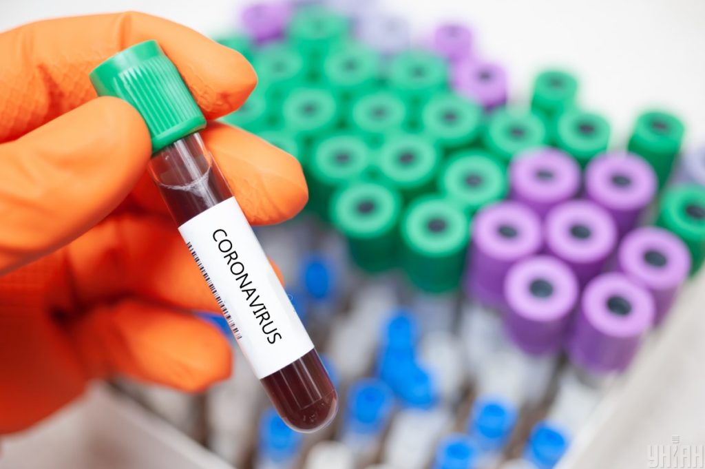 В Україні закупили понад 5,5 тисяч тестів на виявлення коронавірусу — дані з ProZorro