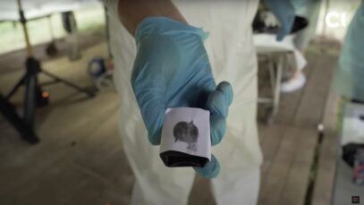 Зображення для публікації '«Щоб не поховали як невідомого»: як судмедексперт відновлює пальці репатрійованих військових, аби взяти відбитки та ідентифікувати особу'