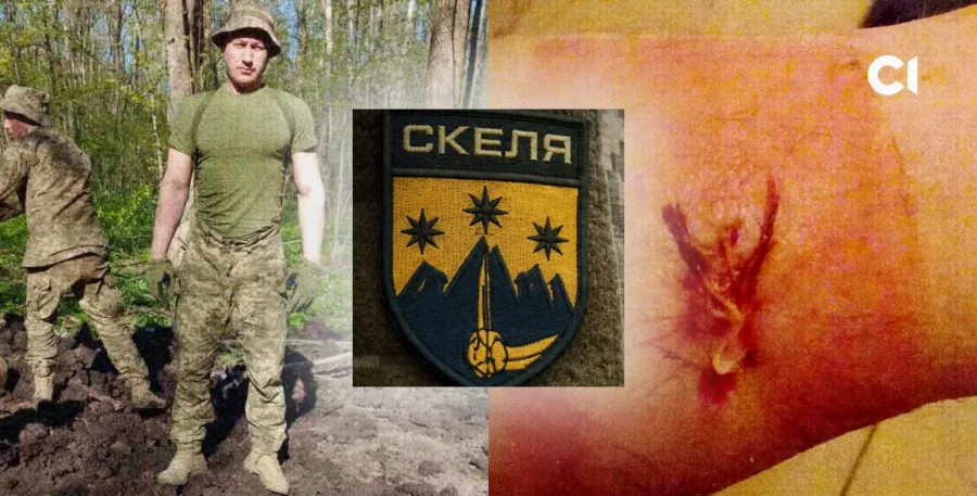 Зображення для публікації 'Стрілянина по військовому «Скелі» з матеріалу «Слідства.Інфо»: ДБР відкрило кримінальне провадження'